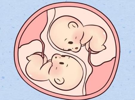 2024泰国试管怀孕选儿子费用贵吗，要花多少钱