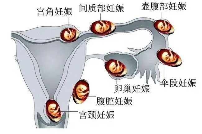 香港试管婴儿多少钱